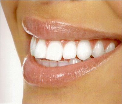 Recent Studies on Teeth Whitening Solutions